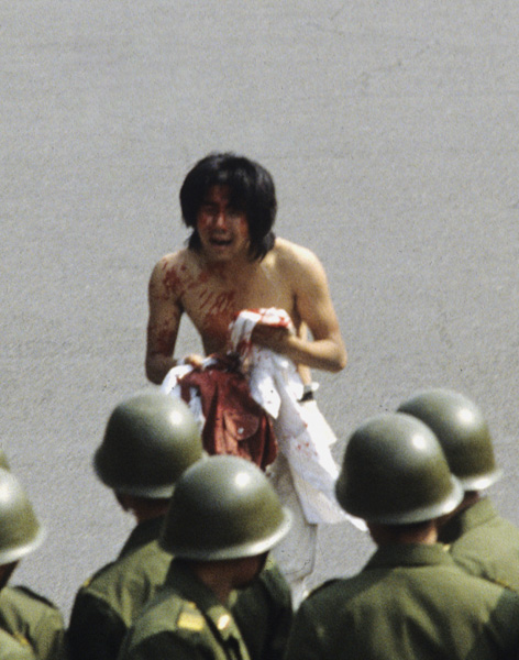 Wounded protester